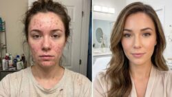 Facial Balance Tip: Why Keeping Blush Away From the Nose Improves Facial Harmony