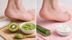 Quick Healing Method Explained: How Simple Kitchen Ingredients Can Repair Dry and Cracked Heels Fast